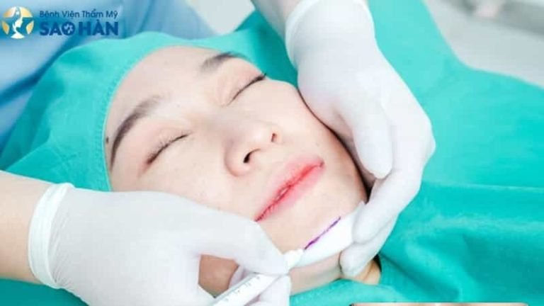 địa chỉ tiêm filler uy tín tại tphcm